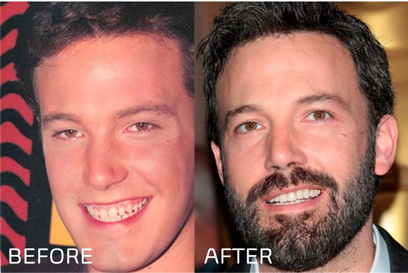 Ben Affleck early transformation